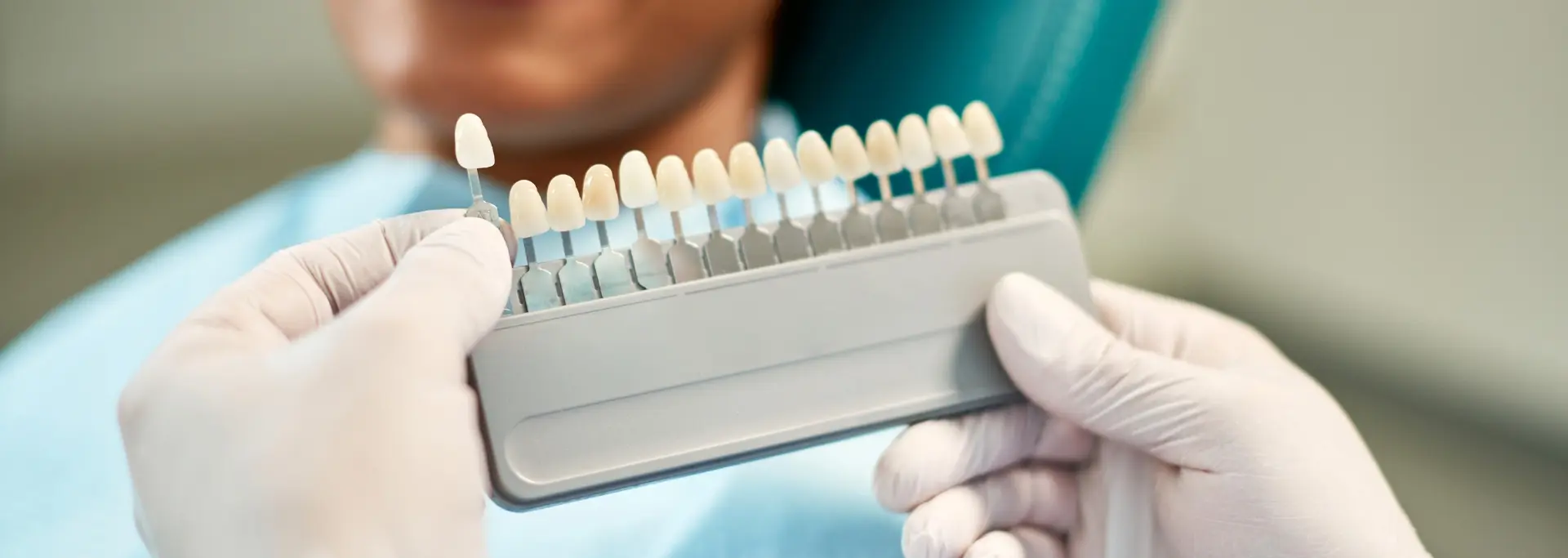 ¿Qué materiales se usan para coronas dentales?