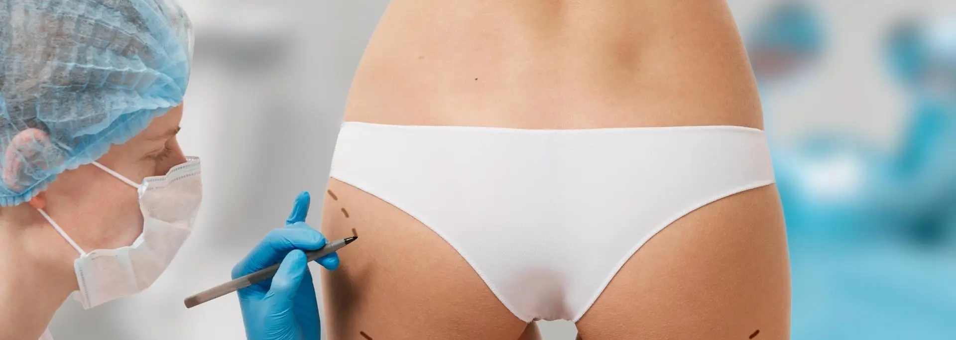 ¿Cómo se hace una lipotransferencia a glúteo?