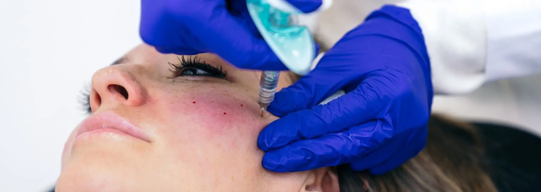 ¿Cuáles son las diferencias entre neuromoduladores y ácido hialurónico y cómo elegir el mejor?