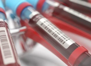 Tipos de análisis de sangre: ¿cuáles hay?