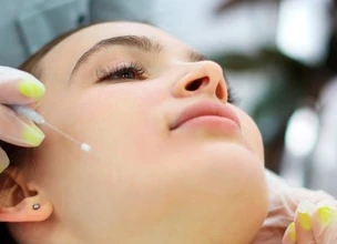 ¿Qué son los hilos PDO monofilamento?