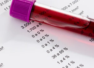 ¿Qué es un hemograma y para qué sirve este análisis?