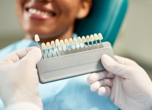 ¿Qué materiales se usan para coronas dentales?