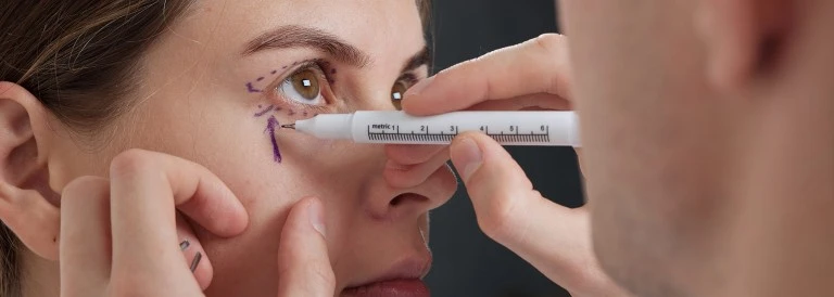 Blefaroplastia: ¿qué es?