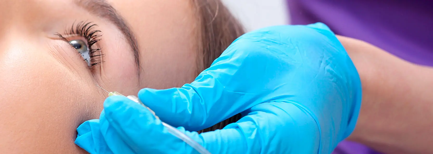 Fillers: ¿qué son?